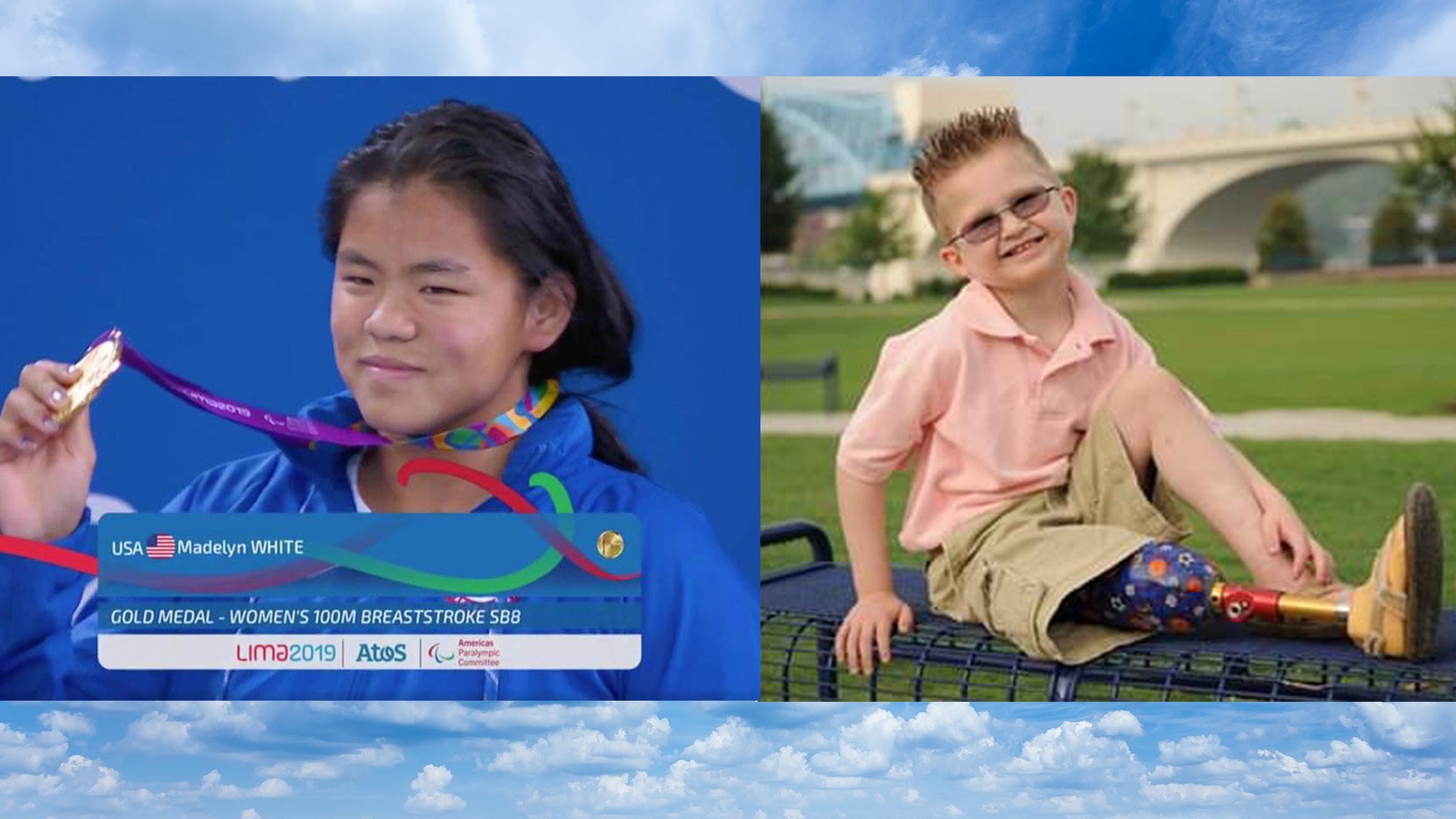 two pictures of a boy with a prosthetic leg and a girl with a prosthetic leg.